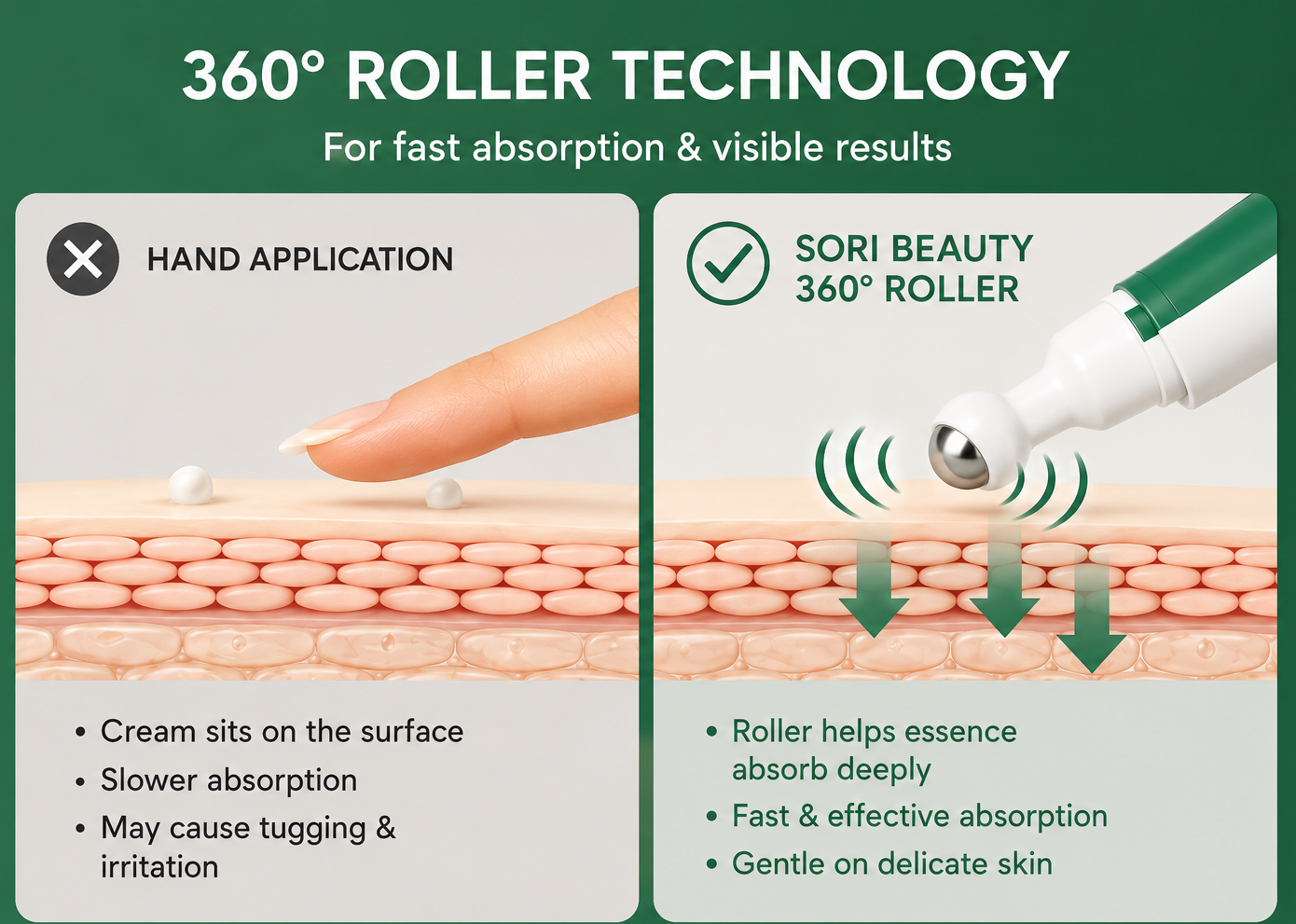 Sori Beauty Anti-Wrinkle Roller