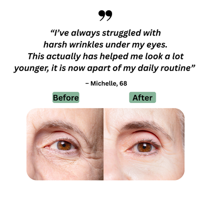 Sori Beauty Anti-Wrinkle Roller