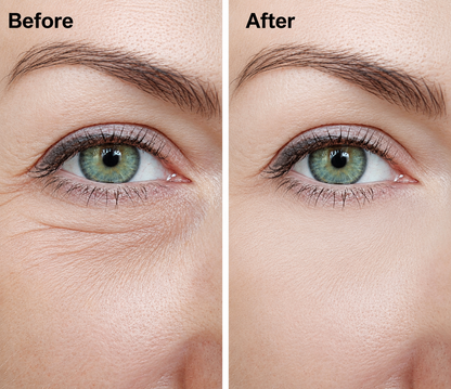 Sori Beauty Anti-Wrinkle Roller